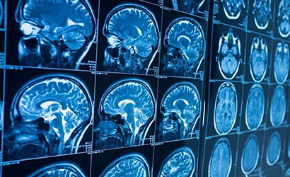 xray of brain scans