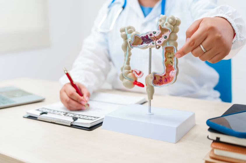 Doctor working with model of a human colon and writing notes